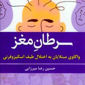 مغز 300x300 - سبد خرید